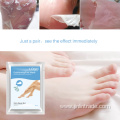 Wholesale Collagen Foot Mask Peeling Feet Peel Mask